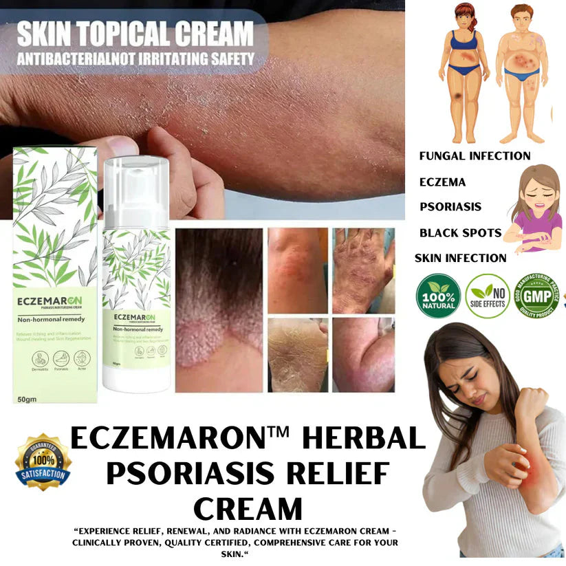 Eczemaron Anti Fungal Cream with Cleaning Spray | Buy 1 Get 1 Free