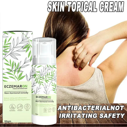 Eczemaron Anti Fungal Cream with Cleaning Spray | Buy 1 Get 1 Free