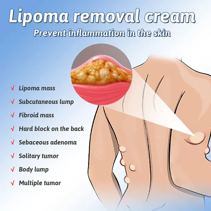 Lipoma Removal Cream - ✅Doctors Recommended (Pack of 2)