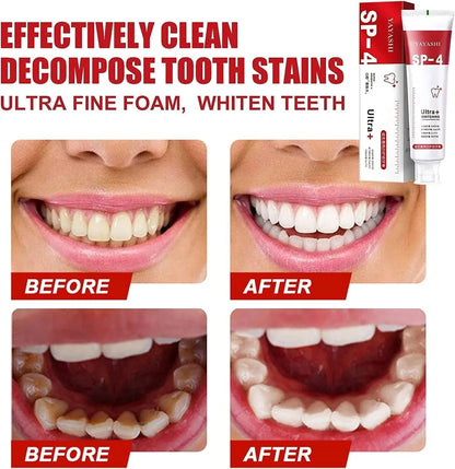 SP-4 Ultra+ Toothpaste 😍Buy 1 + Get 2 FREE😍